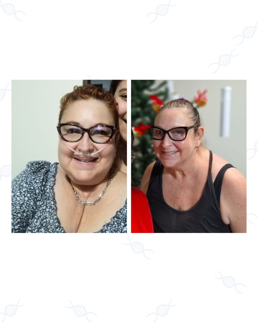 Retratos con iluminación y entorno distintos, fines ilustrativos; quienes aparecen no se presentan como ejemplos clínicos.